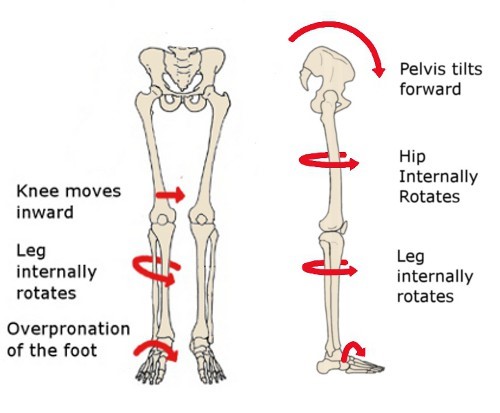 http://www.fixflatfeet.com/wp-content/uploads/2013/03/Pronation-Effects.jpg